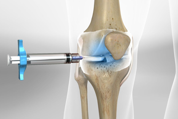 Intra-Articular Injections