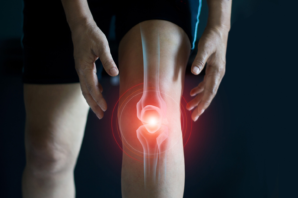 Arthritis