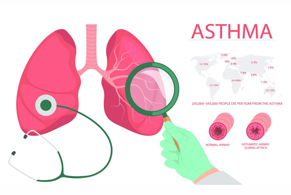 Asthma